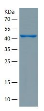 Recombinant Human IFNAR1