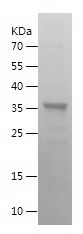 Recombinant Human SKIL