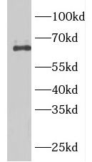 ARHGEF25 antibody