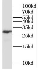 P4HA3 antibody
