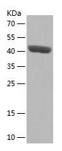 Recombinant Human TRIM11
