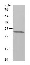 Recombinant Human SLC5A2