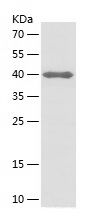 Recombinant Human MAGEA6